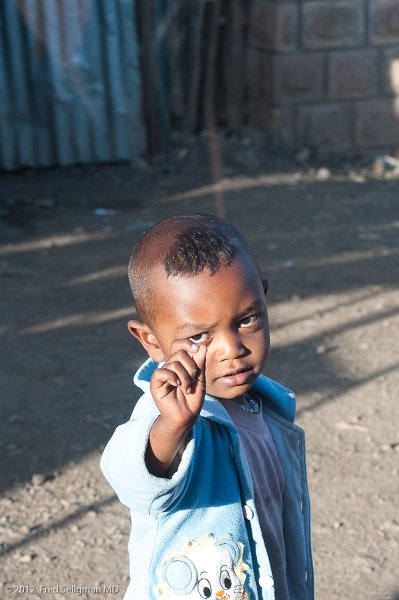 20120403_071613 Nikon D3 2x3.jpg - Youngster with alopecia